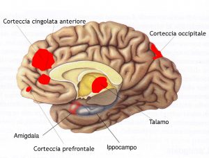 ipnositerapia